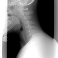 cervical-spine-1129431_640